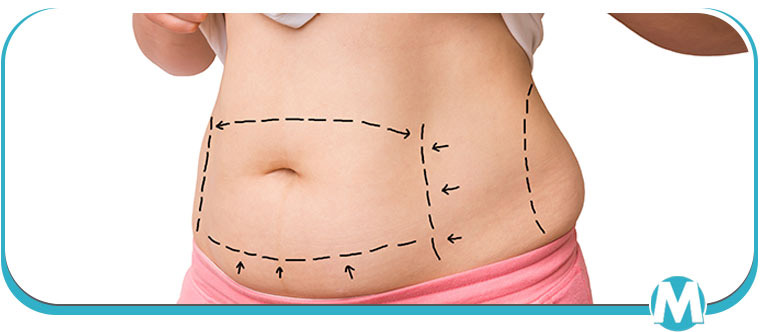 Lipogems Treatment Specialist Near Me in Crown Point IN Lipogems Treatment Specialist Near Me in Crown Point IN