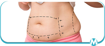 Lipogems Treatment Specialist Near Me in Crown Point IN Lipogems Treatment Specialist Near Me in Crown Point IN