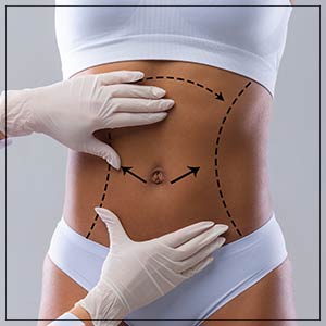 BodyTite/FaceTite with Liposuction Treatment Specialist Near Me in Crown Point IN