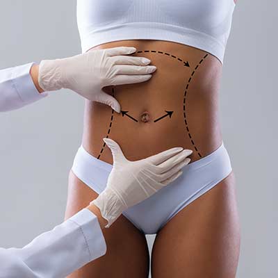 Body Contouring & Skin Tightening Treatment Specialist Near Me in Crown Point IN