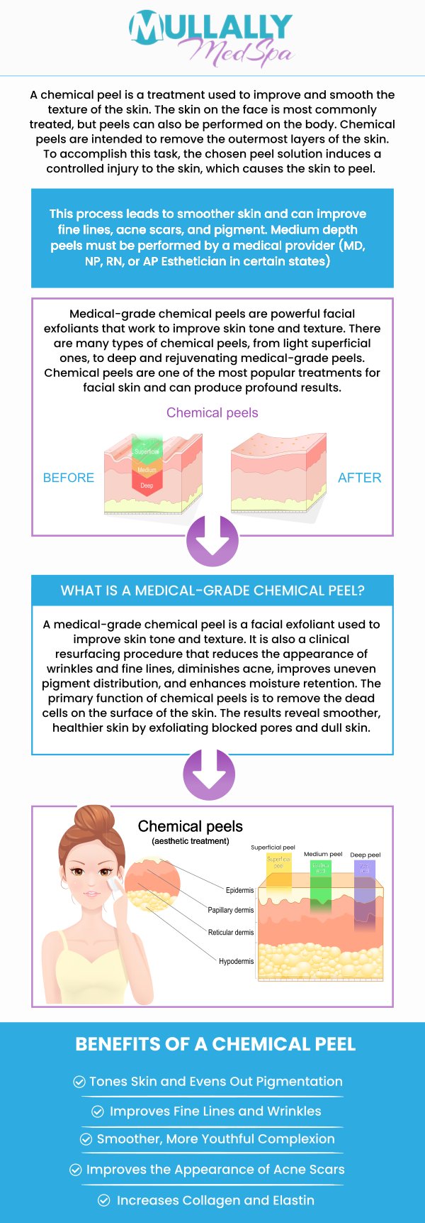 A chemical peel can diminish many signs of aging on the face as well as the hands, neck, and chest. Visit Mullally Medspa and discover the benefits of chemical peels and what wonders they can do for you. Contact us for more information or schedule an appointment online. Our medspa is conveniently located at 11275 Delaware Pkwy Suite C, Crown Point, IN 46307.