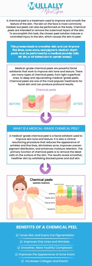 A chemical peel can diminish many signs of aging on the face as well as the hands, neck, and chest. Visit Mullally Medspa and discover the benefits of chemical peels and what wonders they can do for you. Contact us for more information or schedule an appointment online. Our medspa is conveniently located at 11275 Delaware Pkwy Suite C, Crown Point, IN 46307.