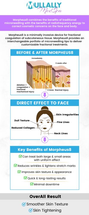 If you are looking for the treatment of stretch marks and wrinkles then visit Mullally MedSpa. We offer morpheus8 to help treat your skin. Contact us or schedule an appointment online. We are conveniently located at 11275 Delaware Pkwy Suite C, Crown Point, IN 46307.