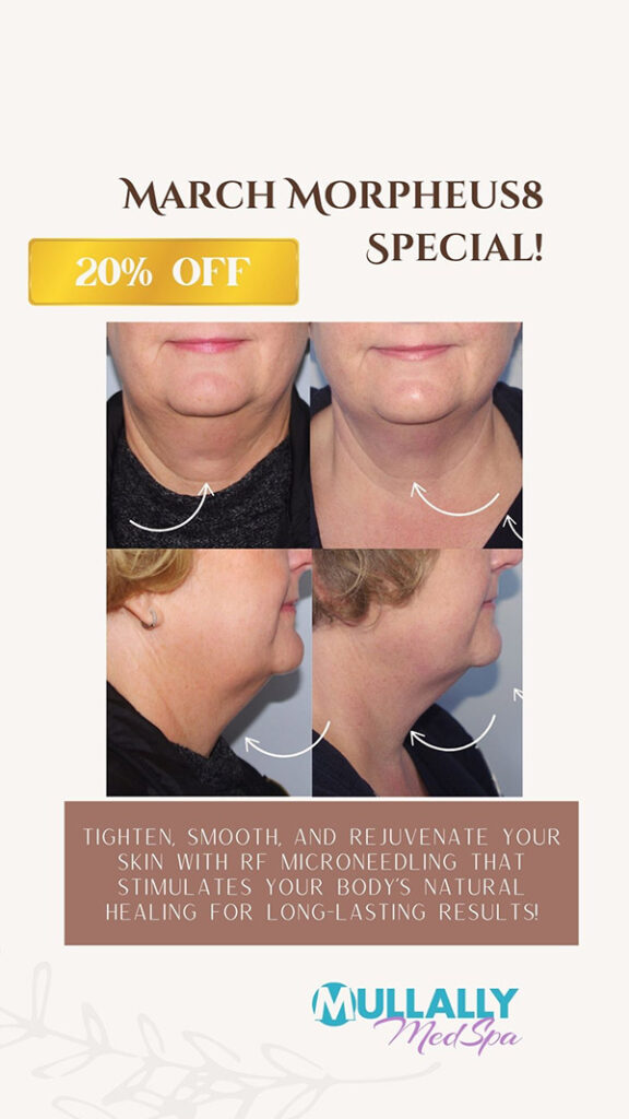 Morpheus8 Treatment Specialist in Crown Point IN