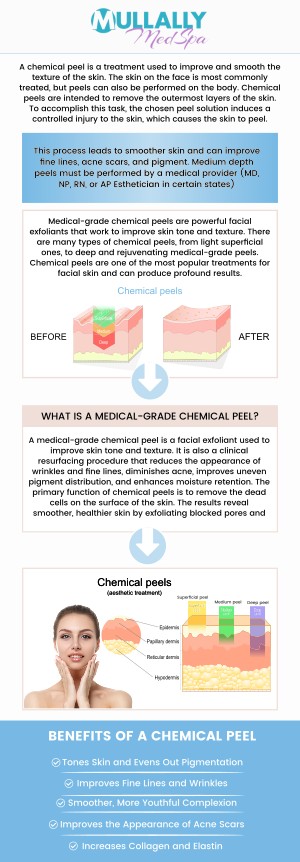 A chemical peel is a skin treatment that uses a solution to exfoliate and remove damaged outer layers. This procedure helps improve skin texture, reduce wrinkles, and treat acne or pigmentation issues. With minimal recovery time, a chemical peel can leave your skin looking smoother, brighter, and more youthful. Visit Mullally Medspa and discover the benefits of chemical peels and what wonders they can do for you. Contact us for more information or schedule an appointment online. Our medspa is conveniently located at 11275 Delaware Pkwy Suite C, Crown Point, IN 46307.