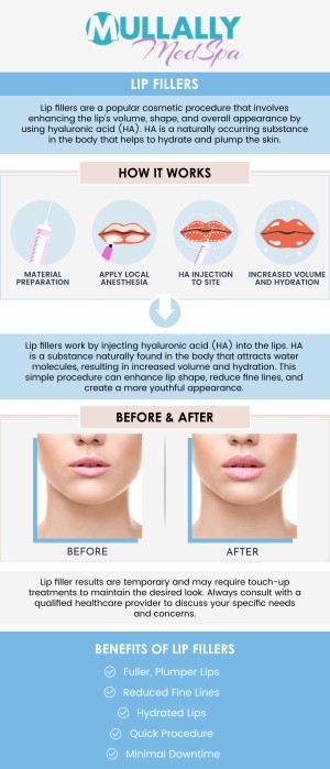 At Mullally MedSpa in Crown Point, IN, achieving your aesthetic goals is affordable, especially when it comes to enhancing your smile with lip filler treatments. Generally, prices range from $500 to $2,000 per session. Our professional team provides top-notch care and state-of-the-art treatments that are both effective and financially accessible. Whether you are looking to add volume for a fuller appearance or smooth out fine lines for a more youthful look, Mullally MedSpa offers competitive pricing for lip filler procedures, making it easier for you to invest in your confidence and beauty. For more information, contact us or book an appointment online. We are conveniently located at 11275 Delaware Pkwy Suite C, Crown Point, IN 46307. At Mullally MedSpa in Crown Point, IN, achieving your aesthetic goals is affordable, especially when it comes to enhancing your smile with lip filler treatments. Generally, prices range from $500 to $2,000 per session. Our professional team provides top-notch care and state-of-the-art treatments that are both effective and financially accessible. Whether you are looking to add volume for a fuller appearance or smooth out fine lines for a more youthful look, Mullally MedSpa offers competitive pricing for lip filler procedures, making it easier for you to invest in your confidence and beauty. For more information, contact us or book an appointment online. We are conveniently located at 11275 Delaware Pkwy Suite C, Crown Point, IN 46307.