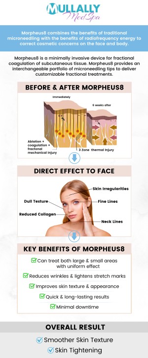 Morpheus8 is a cutting-edge, non-surgical treatment. This procedure stimulates collagen production, tightening and rejuvenating the skin for a smoother, more youthful appearance. Ideal for treating wrinkles, sagging, and uneven skin texture, Morpheus8 delivers noticeable results with minimal downtime. If you are looking for the treatment of stretch marks and wrinkles then visit Mullally MedSpa. We offer morpheus8 to help treat your skin. Contact us or schedule an appointment online. We are conveniently located at 11275 Delaware Pkwy Suite C, Crown Point, IN 46307. Morpheus8 is a cutting-edge, non-surgical treatment. This procedure stimulates collagen production, tightening and rejuvenating the skin for a smoother, more youthful appearance. Ideal for treating wrinkles, sagging, and uneven skin texture, Morpheus8 delivers noticeable results with minimal downtime. If you are looking for the treatment of stretch marks and wrinkles then visit Mullally MedSpa. We offer morpheus8 to help treat your skin. Contact us or schedule an appointment online. We are conveniently located at 11275 Delaware Pkwy Suite C, Crown Point, IN 46307.
