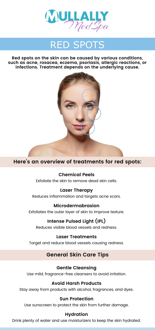 Red spots on the skin can result from various factors, including allergies, infections, heat, or underlying medical conditions. At Mullally MedSpa in Crown Point, IN, our experienced professionals are here to help you identify and treat the root cause of your skin concerns. Whether it's due to eczema, rosacea, or an allergic reaction, our comprehensive approach ensures personalized care tailored to your unique needs. Trust Mullally MedSpa to provide effective solutions for clear, healthy skin. For more information, please contact us today or book an appointment online now. We are conveniently located at 11275 Delaware Pkwy Suite C, Crown Point, IN 46307. Red spots on the skin can result from various factors, including allergies, infections, heat, or underlying medical conditions. At Mullally MedSpa in Crown Point, IN, our experienced professionals are here to help you identify and treat the root cause of your skin concerns. Whether it's due to eczema, rosacea, or an allergic reaction, our comprehensive approach ensures personalized care tailored to your unique needs. Trust Mullally MedSpa to provide effective solutions for clear, healthy skin. For more information, please contact us today or book an appointment online now. We are conveniently located at 11275 Delaware Pkwy Suite C, Crown Point, IN 46307.