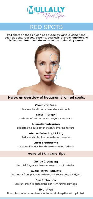 Red spots on the skin can result from various factors, including allergies, infections, heat, or underlying medical conditions. At Mullally MedSpa in Crown Point, IN, our experienced professionals are here to help you identify and treat the root cause of your skin concerns. Whether it's due to eczema, rosacea, or an allergic reaction, our comprehensive approach ensures personalized care tailored to your unique needs. Trust Mullally MedSpa to provide effective solutions for clear, healthy skin. For more information, please contact us today or book an appointment online now. We are conveniently located at 11275 Delaware Pkwy Suite C, Crown Point, IN 46307. Red spots on the skin can result from various factors, including allergies, infections, heat, or underlying medical conditions. At Mullally MedSpa in Crown Point, IN, our experienced professionals are here to help you identify and treat the root cause of your skin concerns. Whether it's due to eczema, rosacea, or an allergic reaction, our comprehensive approach ensures personalized care tailored to your unique needs. Trust Mullally MedSpa to provide effective solutions for clear, healthy skin. For more information, please contact us today or book an appointment online now. We are conveniently located at 11275 Delaware Pkwy Suite C, Crown Point, IN 46307.