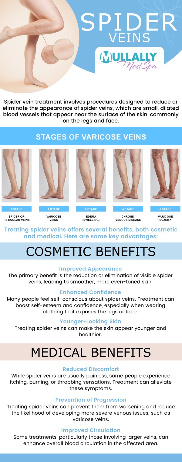 If you are suffering from unsightly veins and require treatment, come to Mullally MedSpa. Our kind and caring staff are here to help you reduce the visibility of your veins. Discover the benefits on how our vein treatments can benefit you. For more information, contact us or schedule an appointment online. Our medspa is conveniently located at 11275 Delaware Pkwy Suite C, Crown Point, IN 46307!