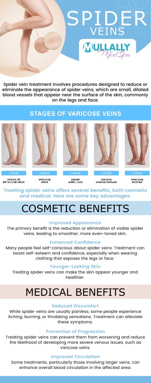 If you are suffering from unsightly veins and require treatment, come to Mullally MedSpa. Our kind and caring staff are here to help you reduce the visibility of your veins. Discover the benefits on how our vein treatments can benefit you. For more information, contact us or schedule an appointment online. Our medspa is conveniently located at 11275 Delaware Pkwy Suite C, Crown Point, IN 46307!