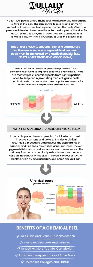 At Mullally MedSpa, our chemical peel treatment can improve the appearance of fine lines, wrinkles, acne scarring, blemishes and rejuvenate your skin! Contact us for more information or schedule an appointment online. We are conveniently located at 11275 Delaware Pkwy Suite C, Crown Point, IN 46307. At Mullally MedSpa, our chemical peel treatment can improve the appearance of fine lines, wrinkles, acne scarring, blemishes and rejuvenate your skin! Contact us for more information or schedule an appointment online. We are conveniently located at 11275 Delaware Pkwy Suite C, Crown Point, IN 46307.
