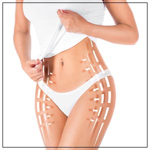 Evolve Skin Tightening Treatment Specialist Near Me in Crown Point IN