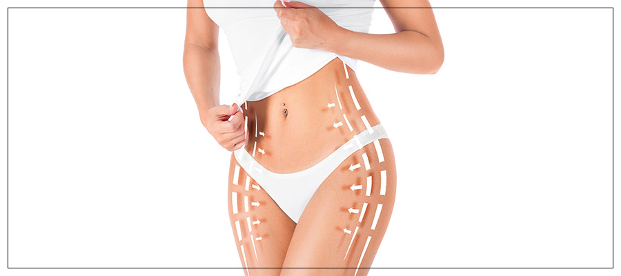 EvolveX by InMode Body Contouring Treatment Near Me in Crown Point, IN EvolveX by InMode Body Contouring Treatment Near Me in Crown Point, IN