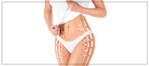 EvolveX by InMode Body Contouring Treatment Near Me in Crown Point, IN EvolveX by InMode Body Contouring Treatment Near Me in Crown Point, IN