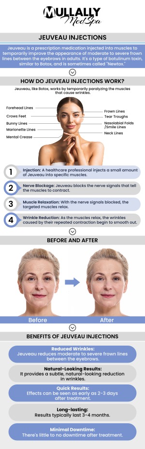 Are you looking for a solution to improve fine lines and wrinkles? Mullally MedSpa offers Jeuveau that is designed to reduce the appearance of facial wrinkles by relaxing the muscles that cause those wrinkles. For more information, contact us today or schedule an appointment online. Our medspa is conveniently located at 11275 Delaware Pkwy Suite C, Crown Point, IN 46307. Are you looking for a solution to improve fine lines and wrinkles? Mullally MedSpa offers Jeuveau that is designed to reduce the appearance of facial wrinkles by relaxing the muscles that cause those wrinkles. For more information, contact us today or schedule an appointment online. Our medspa is conveniently located at 11275 Delaware Pkwy Suite C, Crown Point, IN 46307.