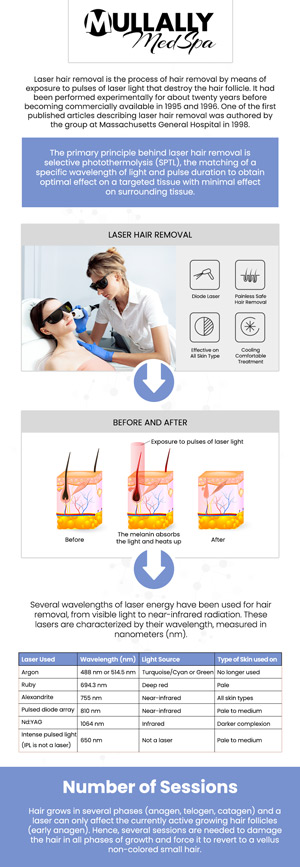 Mullally Medspa provides advanced laser hair removal treatments for smooth, hair-free skin. Our safe, non-invasive procedure targets unwanted hair with precision, offering long-lasting results. Experience the convenience and confidence of laser hair removal with our expert team. Contact us today to learn more or book an appointment online. We are conveniently located at 11275 Delaware Pkwy Suite C, Crown Point, IN 46307! Mullally Medspa provides advanced laser hair removal treatments for smooth, hair-free skin. Our safe, non-invasive procedure targets unwanted hair with precision, offering long-lasting results. Experience the convenience and confidence of laser hair removal with our expert team. Contact us today to learn more or book an appointment online. We are conveniently located at 11275 Delaware Pkwy Suite C, Crown Point, IN 46307!