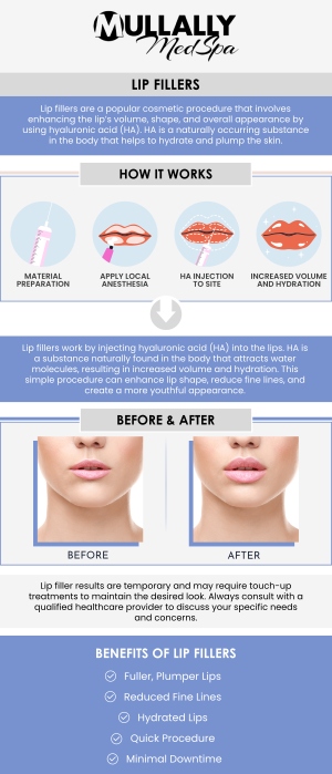 At Mullally MedSpa in Crown Point, IN, achieving your aesthetic goals is affordable, especially when it comes to enhancing your smile with lip filler treatments. Generally, prices range from $500 to $2,000 per session. Our professional team provides top-notch care and state-of-the-art treatments that are both effective and financially accessible. Whether you are looking to add volume for a fuller appearance or smooth out fine lines for a more youthful look, Mullally MedSpa offers competitive pricing for lip filler procedures, making it easier for you to invest in your confidence and beauty. For more information, contact us or book an appointment online. We are conveniently located at 11275 Delaware Pkwy Suite C, Crown Point, IN 46307.