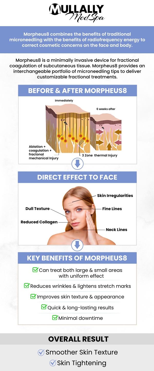 Morpheus8 is an advanced microneedling procedure that stimulates collagen formation to tighten and smooth face and body wrinkles. It is a worthwhile investment if you want to reverse the effects of aging and give your skin a more lifted and restored appearance. The cost of a single Morpheus8 treatment session typically ranges from $500 to $1,500. At Mullally MedSpa, our professional team provides personalized Morpheus8 treatments tailored to your unique skin needs, ensuring optimal results in rejuvenating and lifting your skin. For more information, contact us or book an appointment online. We are conveniently located at 11275 Delaware Pkwy Suite C, Crown Point, IN 46307.