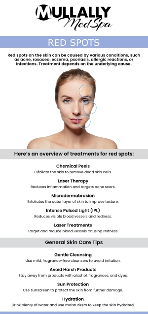 Red spots on the skin can result from various factors, including allergies, infections, heat, or underlying medical conditions. At Mullally MedSpa in Crown Point, IN, our experienced professionals are here to help you identify and treat the root cause of your skin concerns. Whether it's due to eczema, rosacea, or an allergic reaction, our comprehensive approach ensures personalized care tailored to your unique needs. Trust Mullally MedSpa to provide effective solutions for clear, healthy skin. For more information, please contact us today or book an appointment online now. We are conveniently located at 11275 Delaware Pkwy Suite C, Crown Point, IN 46307. Red spots on the skin can result from various factors, including allergies, infections, heat, or underlying medical conditions. At Mullally MedSpa in Crown Point, IN, our experienced professionals are here to help you identify and treat the root cause of your skin concerns. Whether it's due to eczema, rosacea, or an allergic reaction, our comprehensive approach ensures personalized care tailored to your unique needs. Trust Mullally MedSpa to provide effective solutions for clear, healthy skin. For more information, please contact us today or book an appointment online now. We are conveniently located at 11275 Delaware Pkwy Suite C, Crown Point, IN 46307.