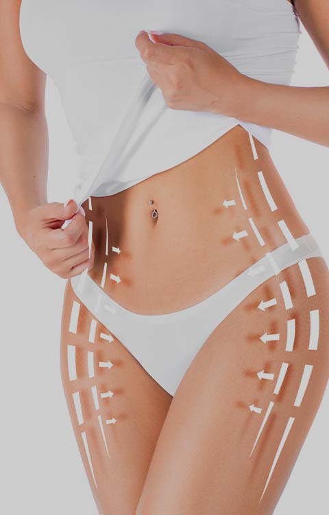 EvolveX Body Contouring at Mullally MedSpa Located in Crown Point IN