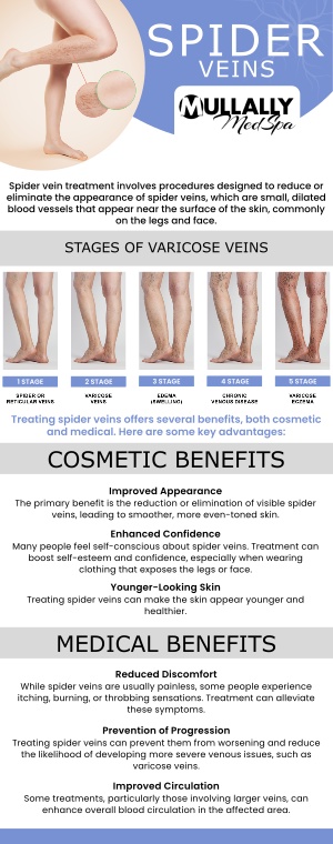 If you are suffering from unsightly veins and require treatment, come to Mullally MedSpa. Our kind and caring staff are here to help you reduce the visibility of your veins. Discover the benefits on how our vein treatments can benefit you. For more information, contact us or schedule an appointment online. Our medspa is conveniently located at 11275 Delaware Pkwy Suite C, Crown Point, IN 46307!